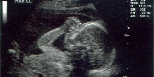 Ultrasound Opportunity Act