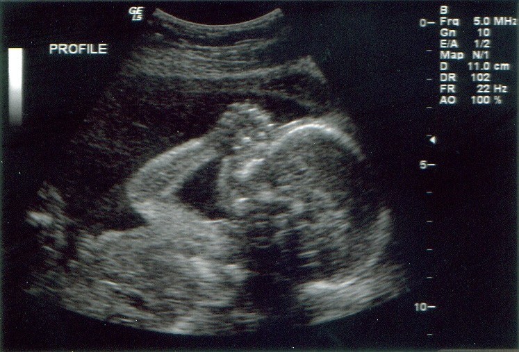 Ultrasound Opportunity Act