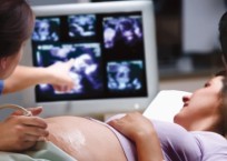 Ultrasound Opportunity Act in Springfield