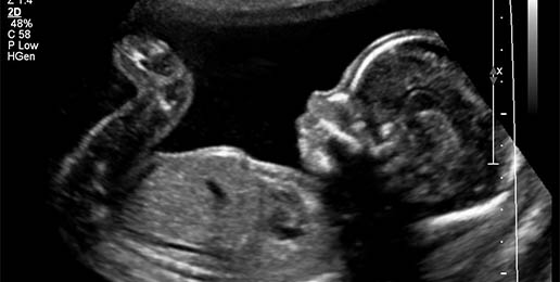 IL Legislators Want to Spend Taxes on Abortions
