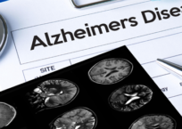 Marketing Death and Alzheimer’s Disease