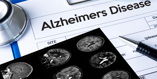 Marketing Death and Alzheimer’s Disease