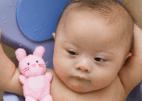 Japanese Scientists Can Erase Down Syndrome?
