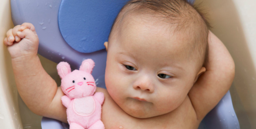 Japanese Scientists Can Erase Down Syndrome? Japanese Scientists Can Erase Down Syndrome?